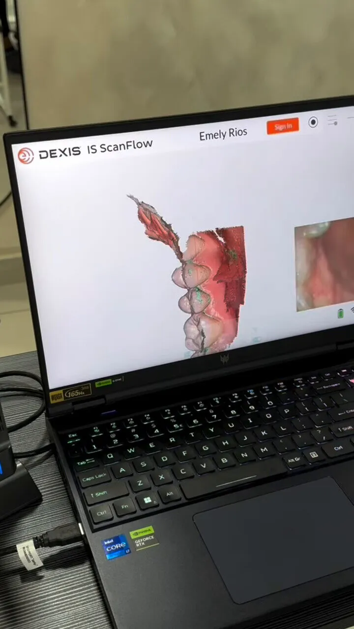 Escaneo intraoral en 3D en la pantalla del consultorio